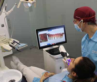 Escaner Dental Intraoral